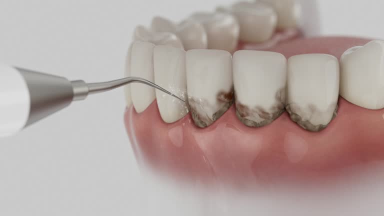 Reliable Dental contractor in Dresden, OH by Dentist Open Now